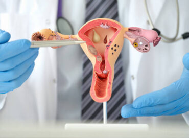gynaecology
